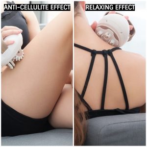 Cellmassager – Anticelulitni masažni aparat 03