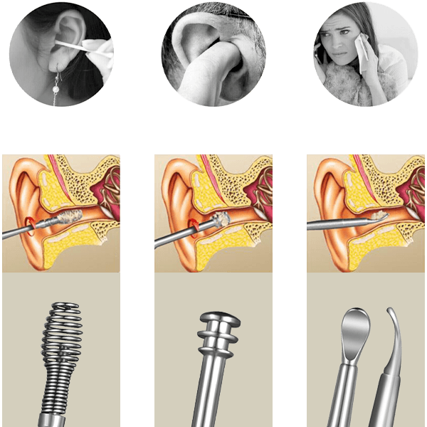 Komplet za čiščenje ušes 03